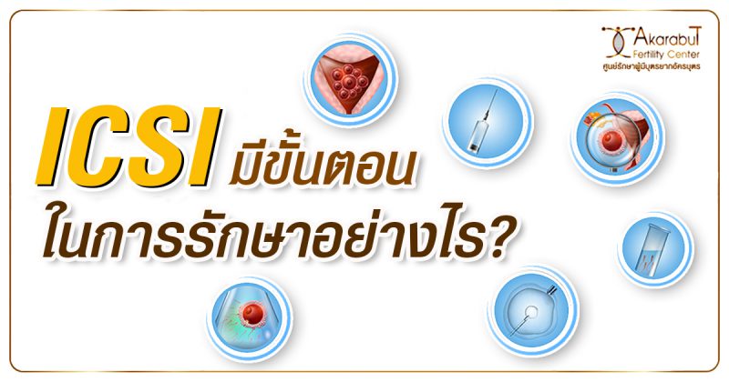 icsiมีขั้นตอนในการรักษาอย่างไร