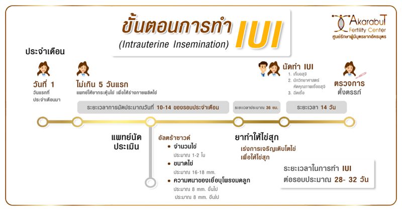 ขั้นตอนการทำIUI