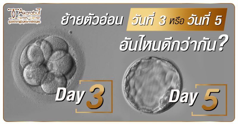 ย้ายตัวอ่อนวันที่3หรือวันที่5อันไหนดีกว่ากัน